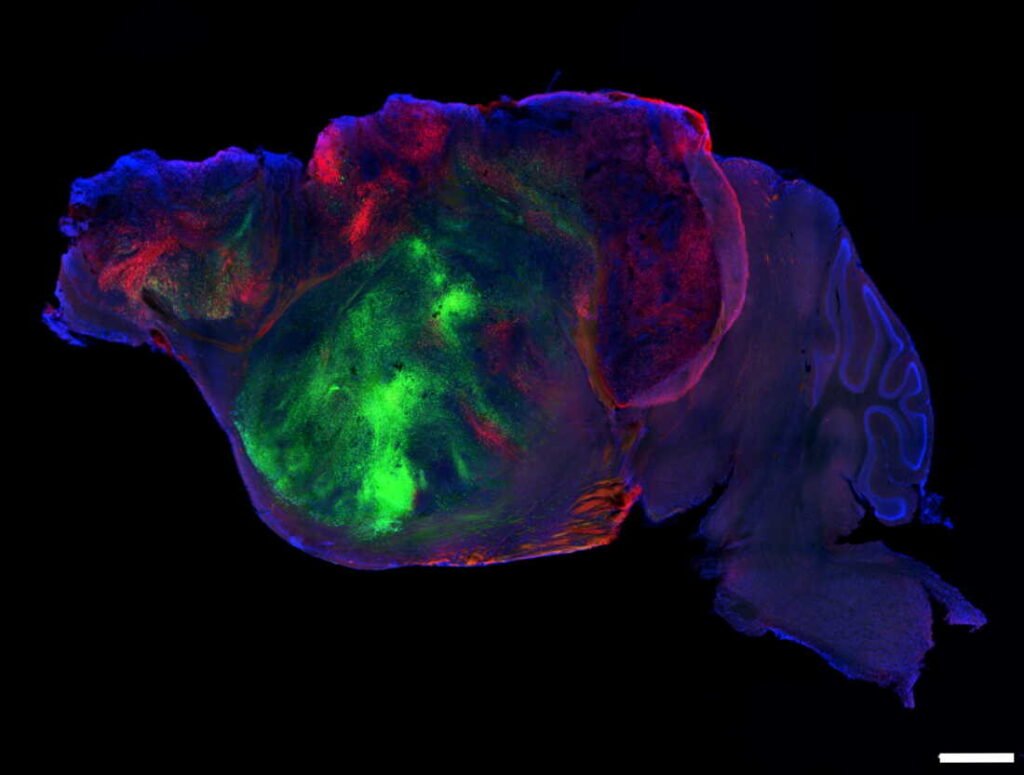 Human brain cells under a microscope