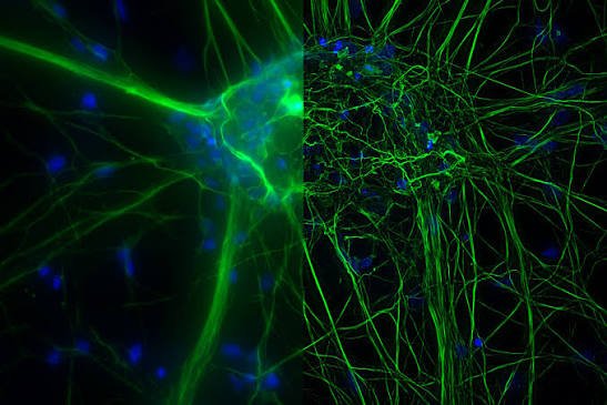 Neuroscience researchers analyzing brain cells