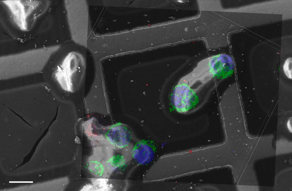 Cryo-electron tomography imaging of cellular structures
